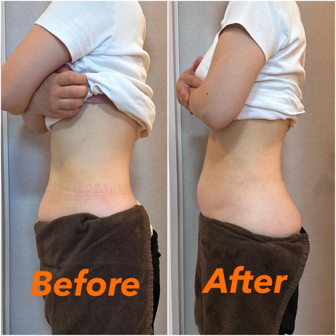 下腹部ぽっこりには腸もみを！